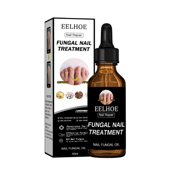 EELHOE Nail Repair Solution, Thickening And Brightening Nails Removing Gray Nail Repair Nourishing Nail Care Solution - Image 4