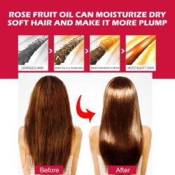 EELHOE Rosehip Facial Oil For Facial And Body Hydration, Nourishing Skin Care, Smooth Hair Care, And Massage Oil - Image 4
