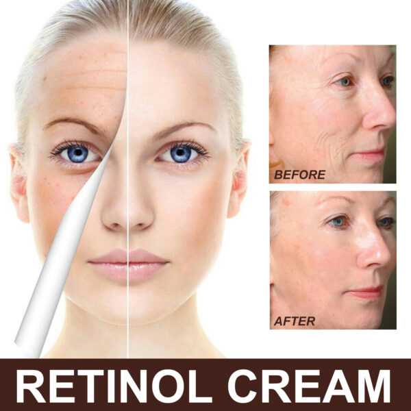 Retinol Anti Aging Wrinkle Removal Skin Firming Cream, EELHOE Retinol Cream Anti-Aging With Hyaluronic Acid And Vitamin - Image 6