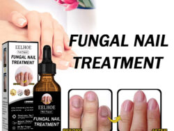EELHOE Nail Repair Solution Thickening And Shining Nail Removal Dead Skin Repairing And Moisturizing Nail Nutritional Care Liquid