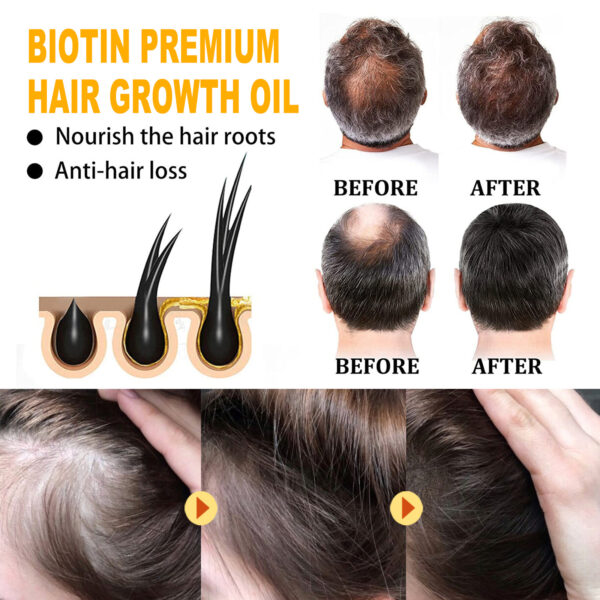 EELHOE Biotin Hair Treatment Oil Deeply Moisturizing Scalp Massage Treatment Thick And Smooth Hair Care Oil - Image 6