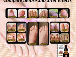 EELHOE Nail Repair Solution, Thickening And Brightening Nails Removing Gray Nail Repair Nourishing Nail Care Solution