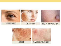 OUHOE Snail 96 Collagen Power Essence Repairs Skin Barrier, Moisturizes And Desalinates Black Spot Snail Essence