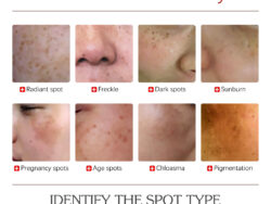 EELHOE Color Repair Cream Replenishes, Moisturizes, And Lightens Freckles, Black Spots, Blemishes, Melasma, And Melanin Skin Cream