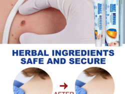 EELHOE Fragrance Removing Cream, Cleansing Skin Repair Care Body Face Removal Face Label Keyu Cream